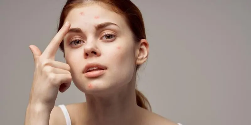 cac-vi-tri-cua-mun-moc-noi-len-dieu-gi