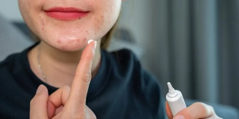 cac-vi-tri-cua-mun-moc-noi-len-dieu-gi