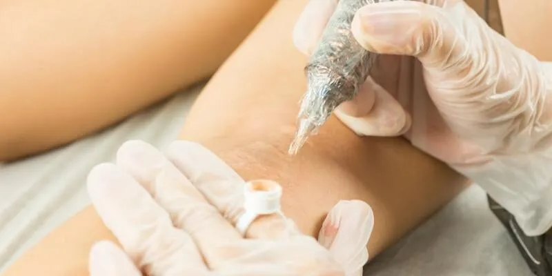 phuong-phap-dieu-tri-seo-hieu-qua-nhat-2022