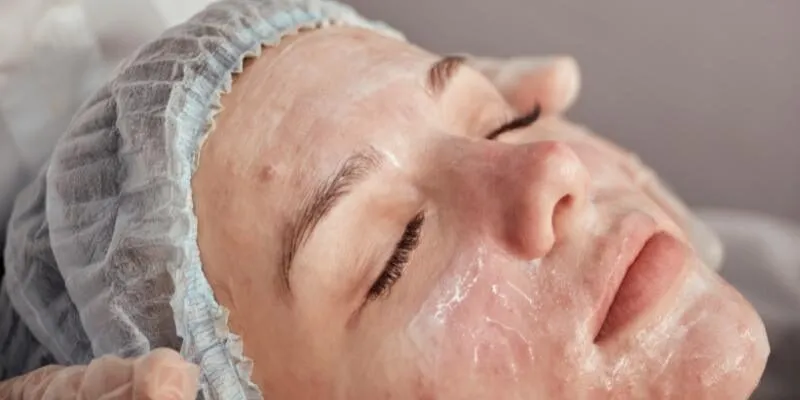 dieu-tri-mun-khong-seo-medi-acne