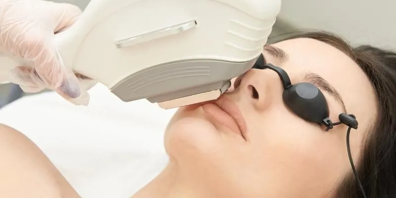 triet-long-vinh-vien-laser-diolight