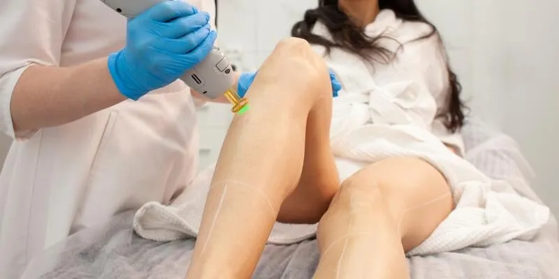 triet-long-vinh-vien-laser-diolight