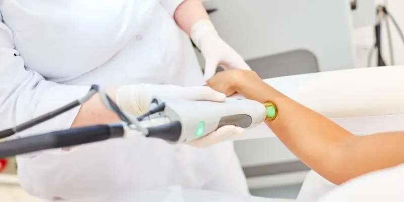 triet-long-vinh-vien-laser-diolight